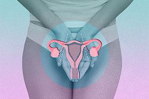 Should You Remove Your Fallopian Tubes to Decrease Ovarian Cancer Risk?